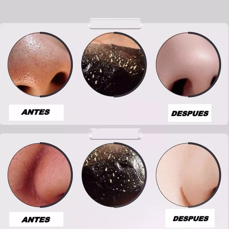 La máscara facial que elimina puntos negros al instante